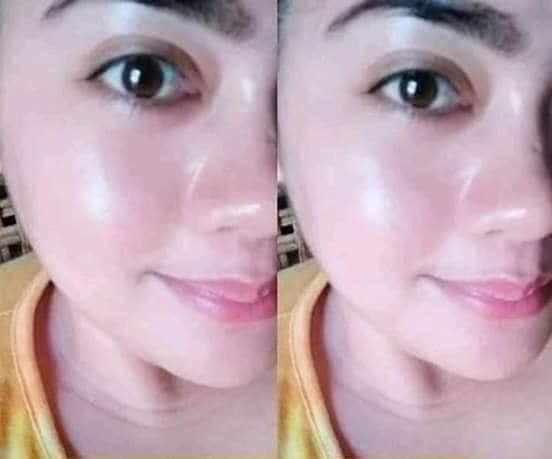 Brilliant Skin Essentials Whitening Facial Set